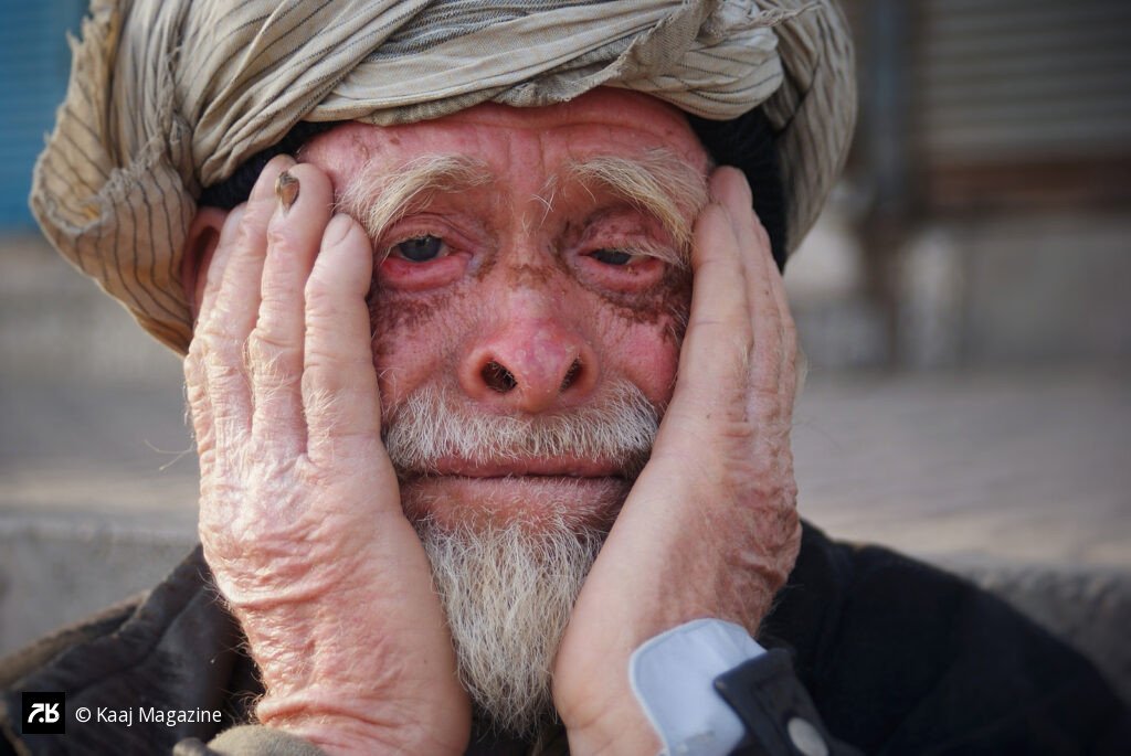 Weathered hands holding a tired face