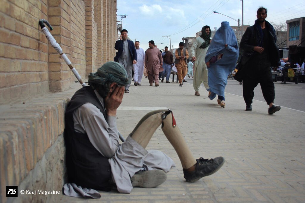 Man with a prosthetic leg